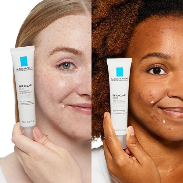 La Roche-Posay Effaclar Duo Dual Action Acne Spot Treatment Cream with Benzoyl Peroxide Acne Treatment, Blemish Cream for Acne - Image 20
