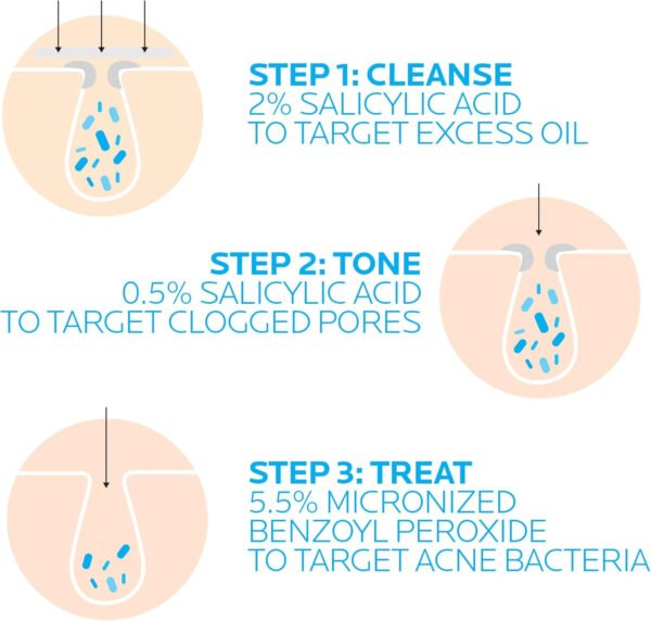 La Roche-Posay Effaclar Duo Dual Action Acne Spot Treatment Cream with Benzoyl Peroxide Acne Treatment, Blemish Cream for Acne - Image 28