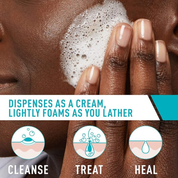 CeraVe Acne Foaming Cream Cleanser, 5 Fl Oz (Pack of 1), Packaging may Vary - Image 3